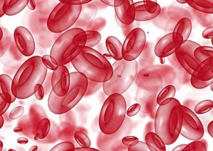 大红大紫的“红人病”——真性红细胞增多症