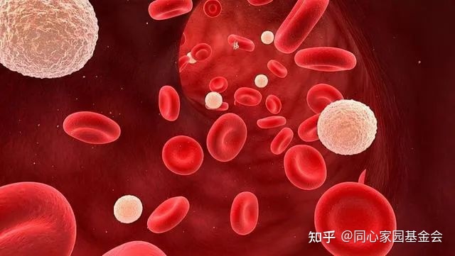 疾病指南 | 真性红细胞增多症诊断与治疗中国专家共识（2016年版）