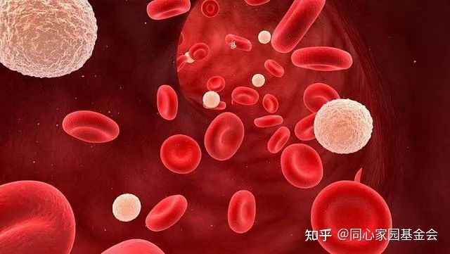 疾病指南 | 真性红细胞增多症诊断与治疗中国专家共识（2016年版）