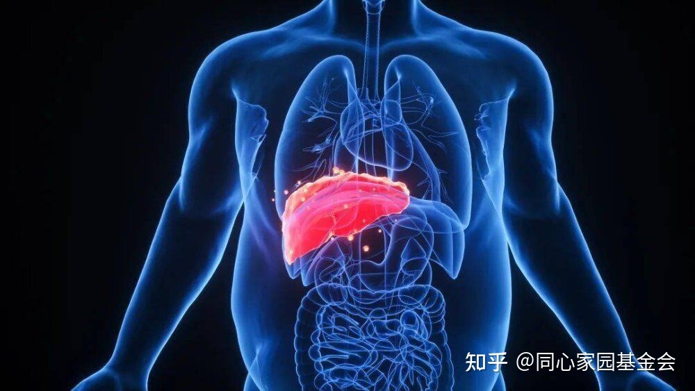 科普时间 | 骨髓增殖性肿瘤（MPN）应用干扰素对肝脏有哪些影响？