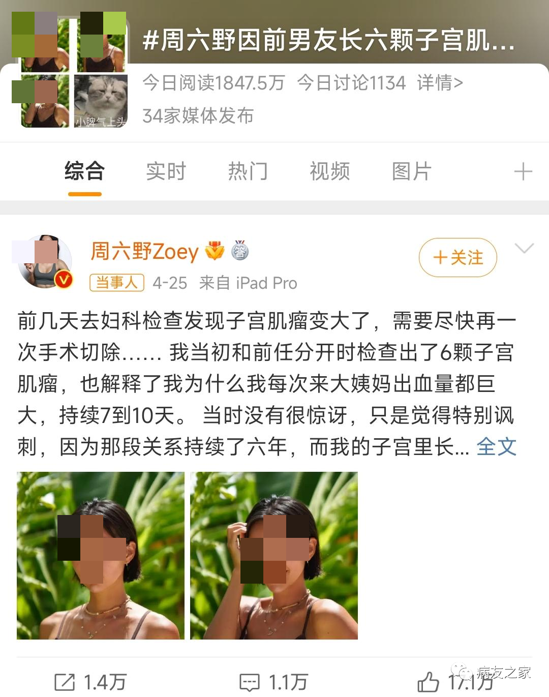 你知道吗 | 生气容易得子宫肌瘤？