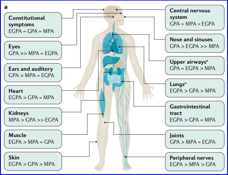 扶琼教授解读:ANCA血管炎的临床表现