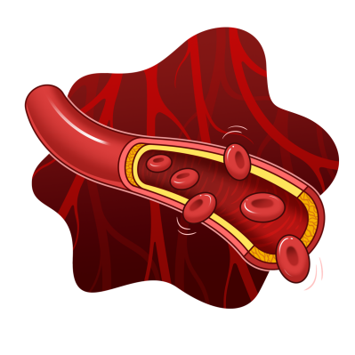 科普时间 | 现代医学也“放血”？揭秘真性红细胞增多症的“放血疗法”